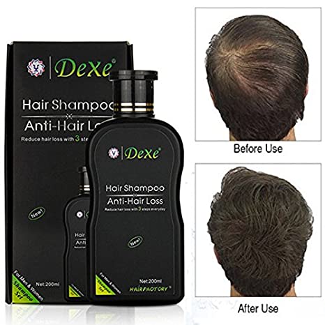 Dexe Anti Hair Loss Shampoo